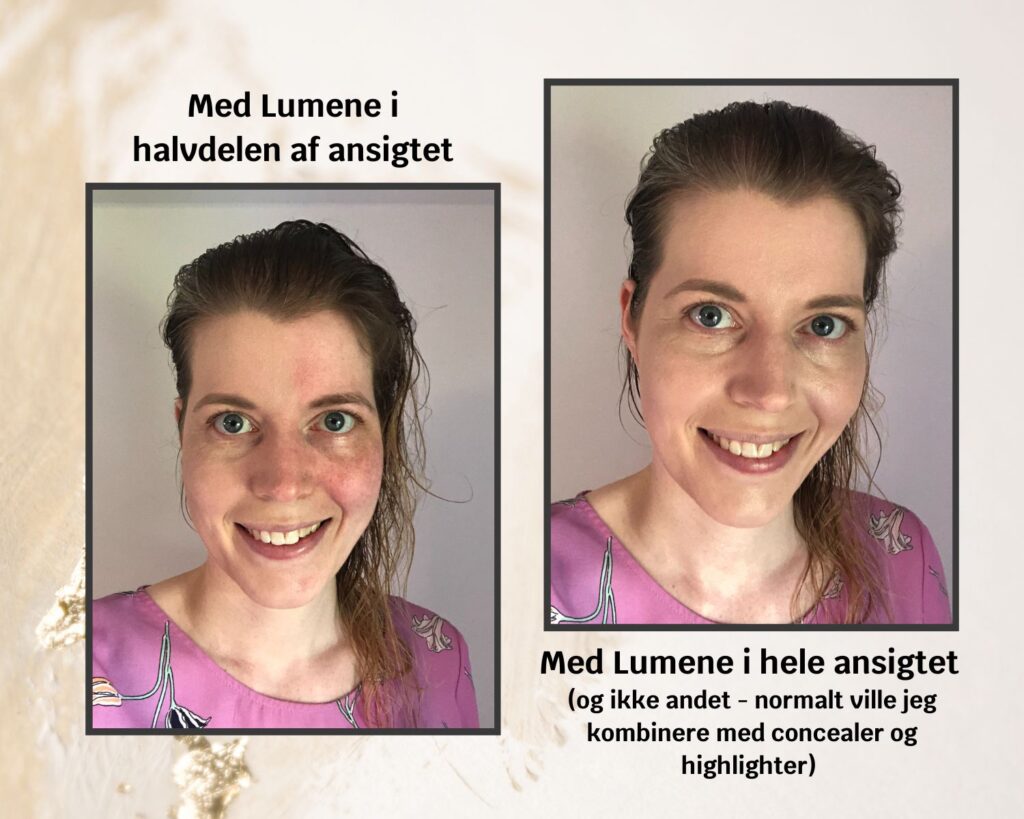 Billede uden og med creme mod rødme i ansigtet
